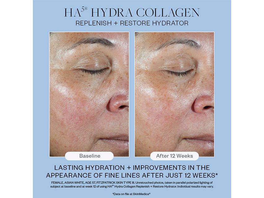 SkinMedica HA5 Hydra Collagen Replenish + Restore Hydrator