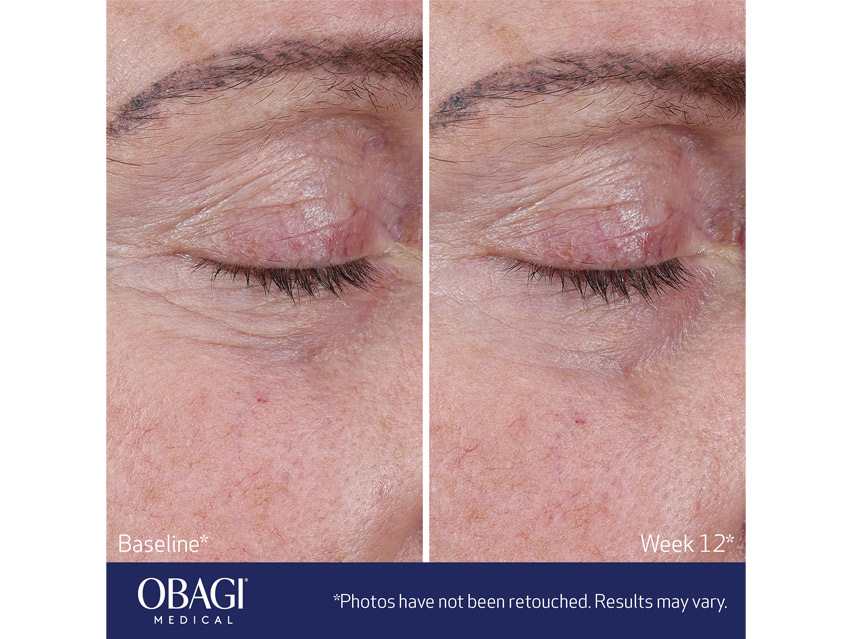 Obagi ELASTIderm Advanced Filler Concentrate