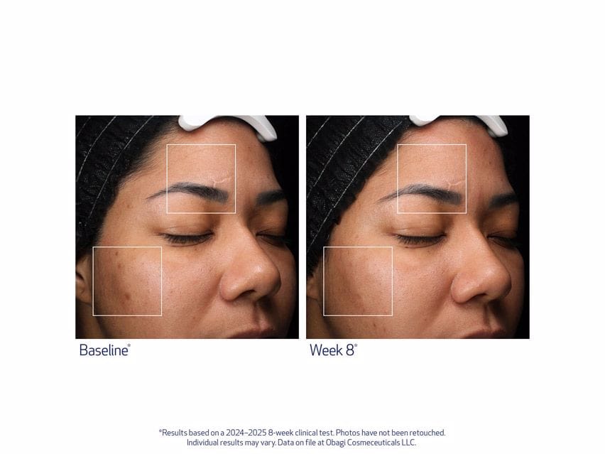 Obagi Retinol + PHA Refining Night Cream