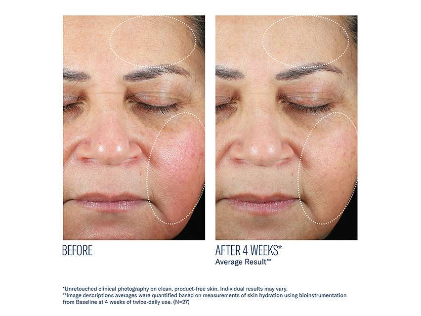 skinbetter science Trio Luxe Moisture Treatment