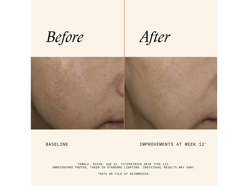 SkinMedica Even &amp; Correct Advanced Brightening Treatment Serum