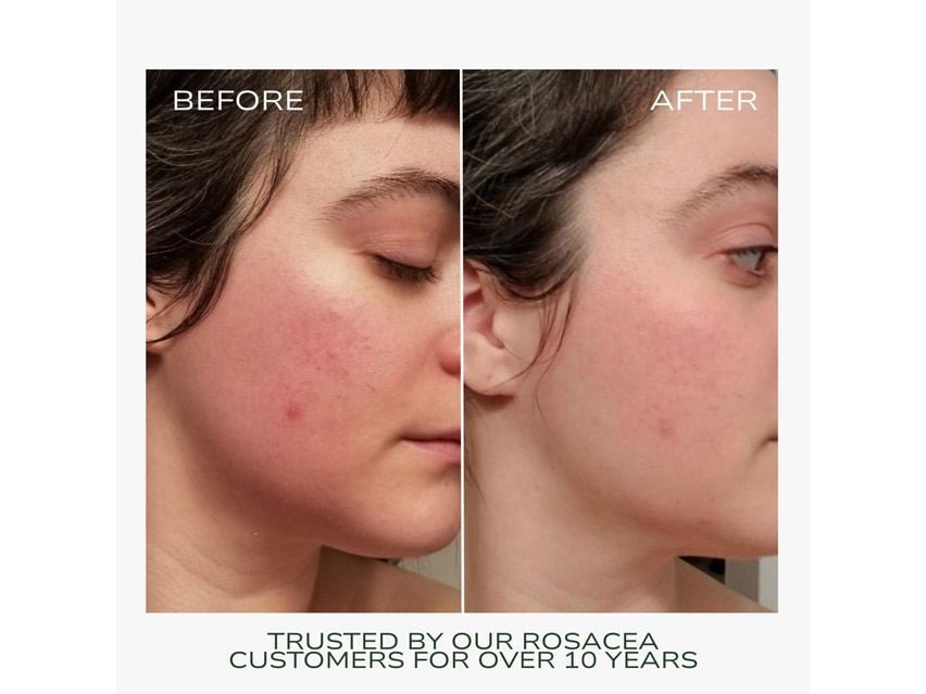 Fitglow Beauty Redness Rescue Cream