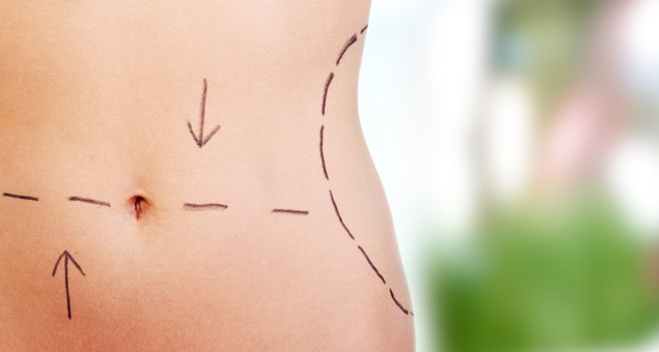 The Dangers of Cheap Liposuction