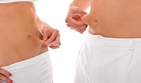 What is tumescent liposuction and SmartLipo?