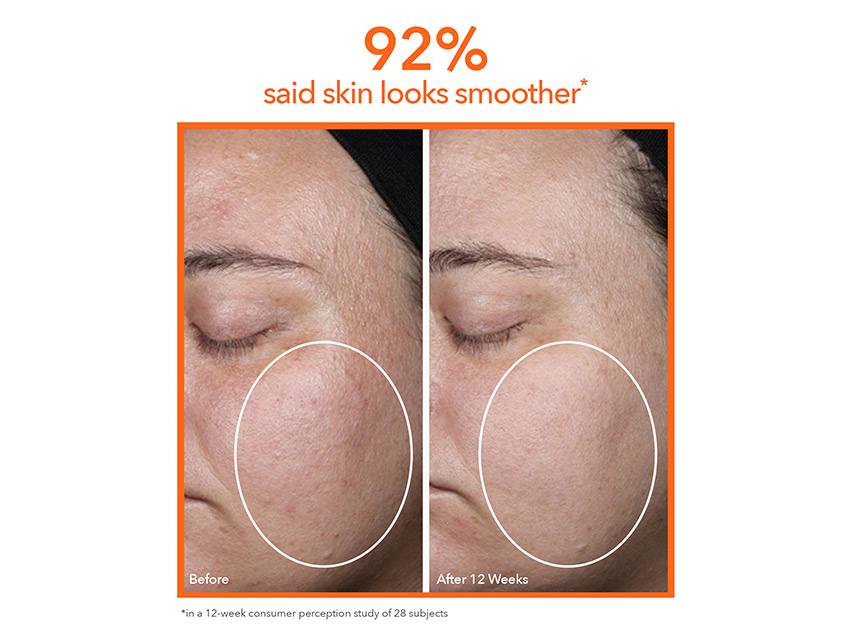 Dr. Dennis Gross Skincare DRx SpectraLite™ FaceWare Pro