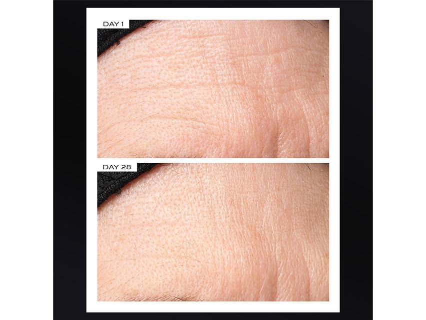 111SKIN Exosome At-Home Face Lift Protocol