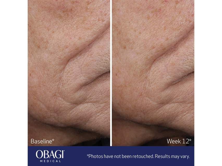 Obagi ELASTIderm Lift Up &amp; Sculpt Facial Moisturizer