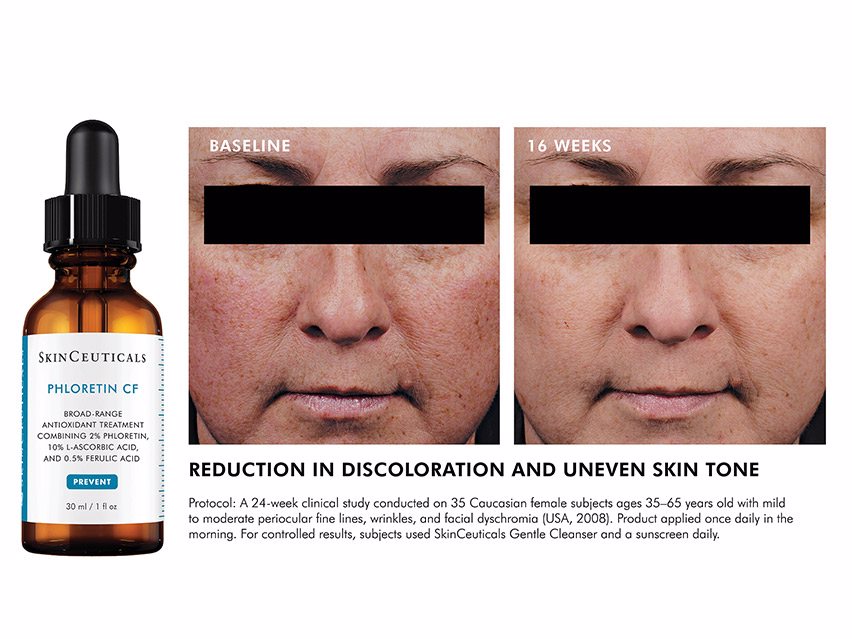 SkinCeuticals Discoloration Prevent & Correct Set
