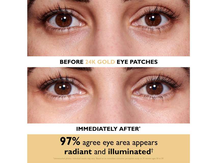 Peter Thomas Roth Eye Patch Travel Pack - Limited Edition