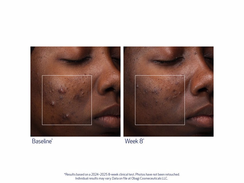 Obagi Retinol + PHA Refining Night Cream