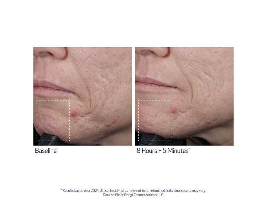 SUZANOBAGIMD Moisture Restore Hydration Replenishing Cream