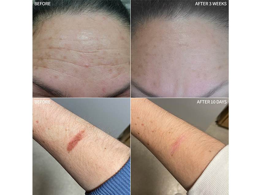 RescueMD DNA Repair Complex &amp; Revitalizing Body Cream Duo - $336 Value!