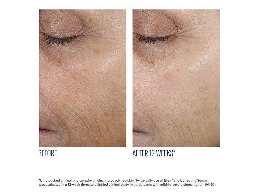 skinbetter science Even Tone Correcting Serum