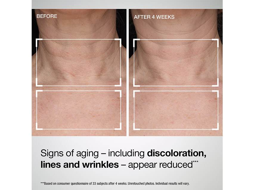 Strivectin TL Advanced Tightening Neck &amp; Chest Lotion SPF 35