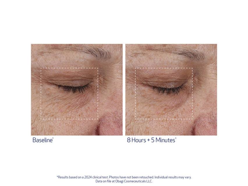 SUZANOBAGIMD Moisture Restore Hydration Replenishing Cream