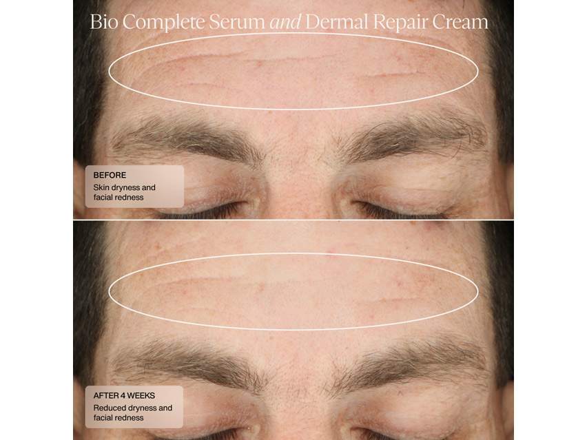 Sent&#233; Dermal Repair Cream &amp; Bio Complete Serum Duo - $203 Value!