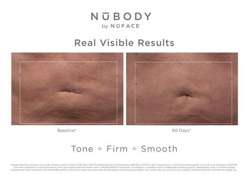 NuFACE NuBODY Skin Toning Device | Body Toner | LovelySkin