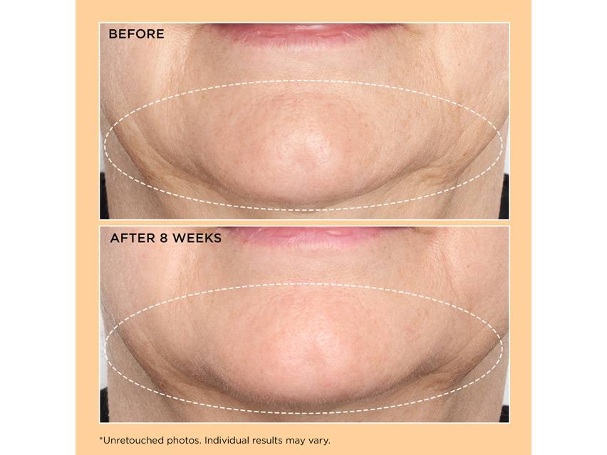 Perricone MD Neuropeptide Deep Crease Serum