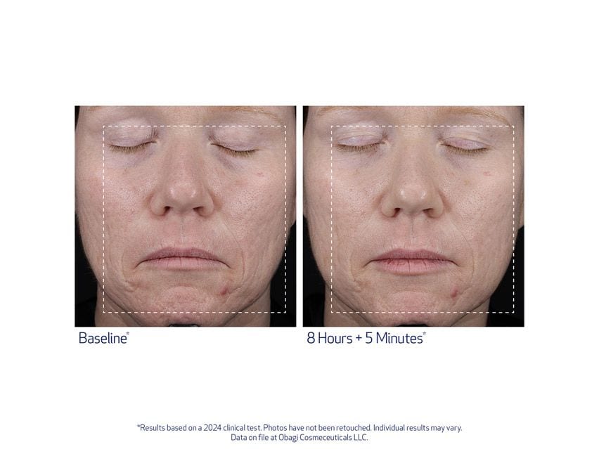 SUZANOBAGIMD Moisture Restore Hydration Replenishing Cream