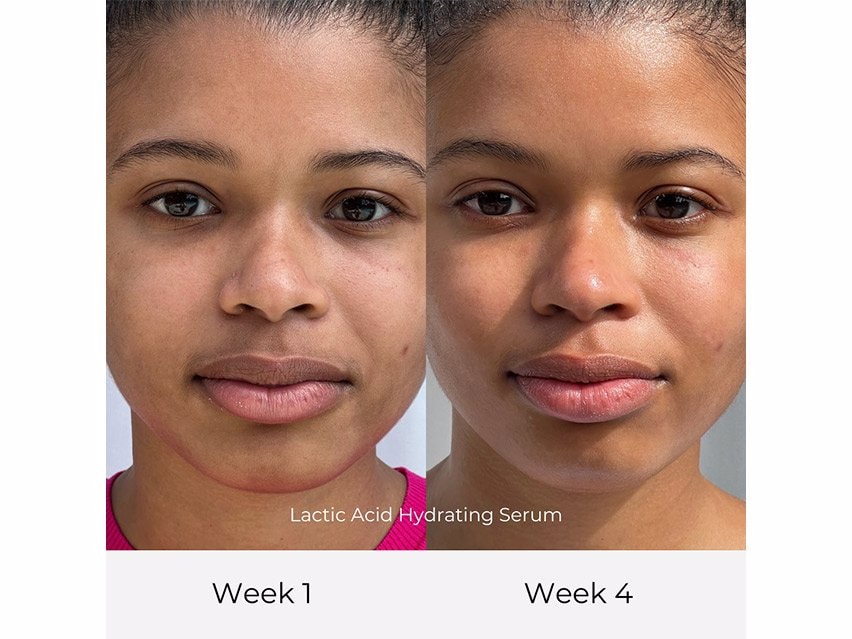 Olga Lorencin Skin Care Lactic Acid Hydrating Serum - 1.0 fl oz
