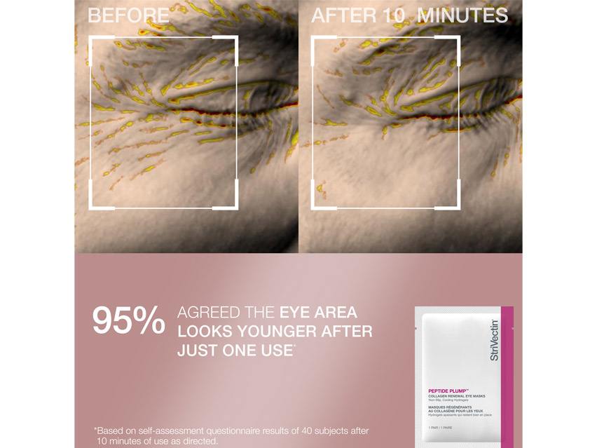 StriVectin Clinically Proven Minis - Limited Edition