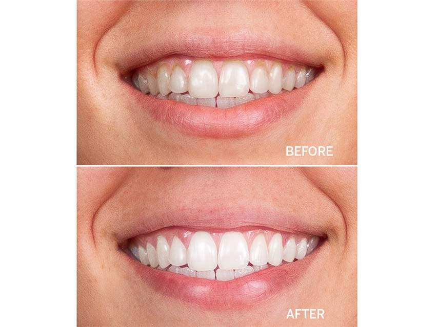 Supersmile Fluoride Free Professional Whitening Toothpaste - Rosewater Mint