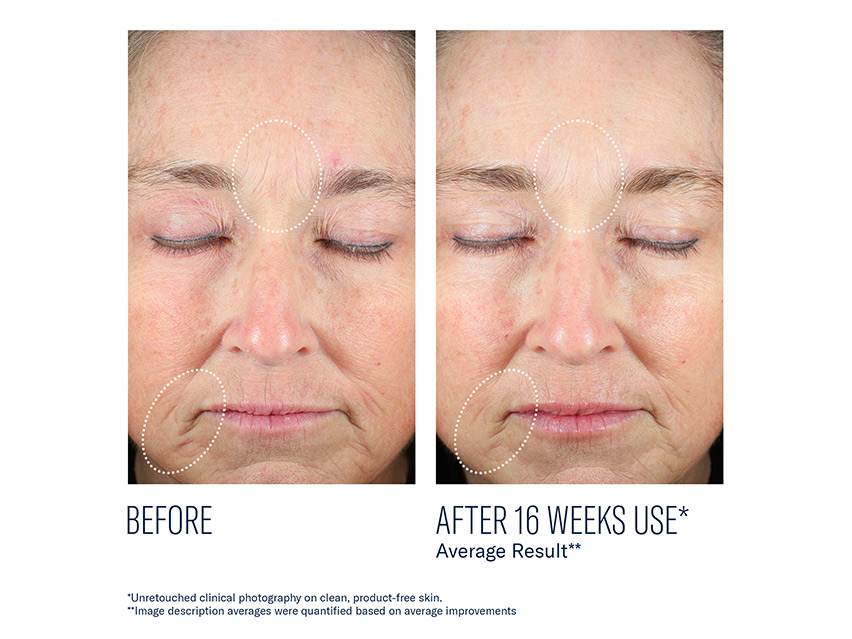 skinbetter science Mystro Revive Renewing Serum