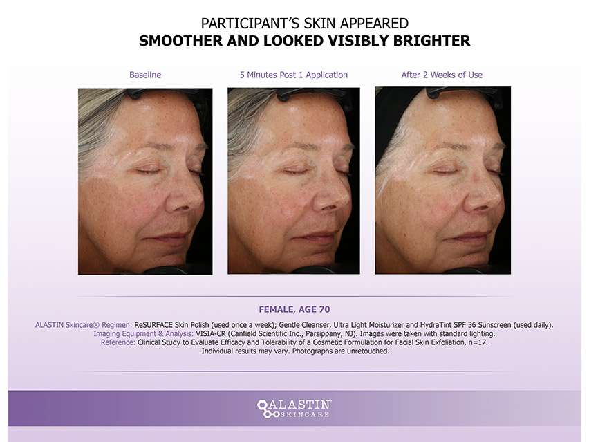ALASTIN Skincare ReSURFACE Skin Polish