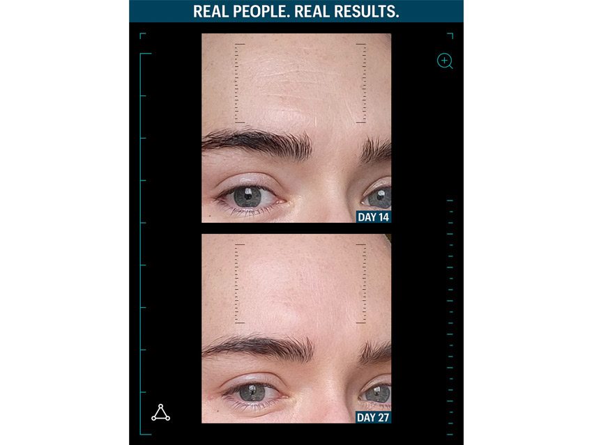 Allies of Skin Advanced Lift &amp; Repair Skin and Lip Duo