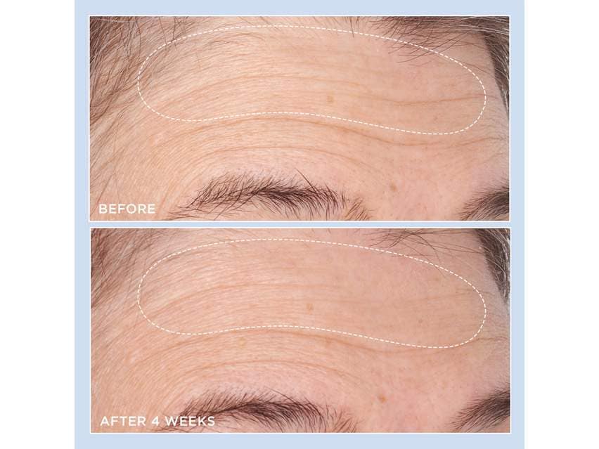 Perricone MD Cold Plasma Plus+ Advanced Hydrating Complex