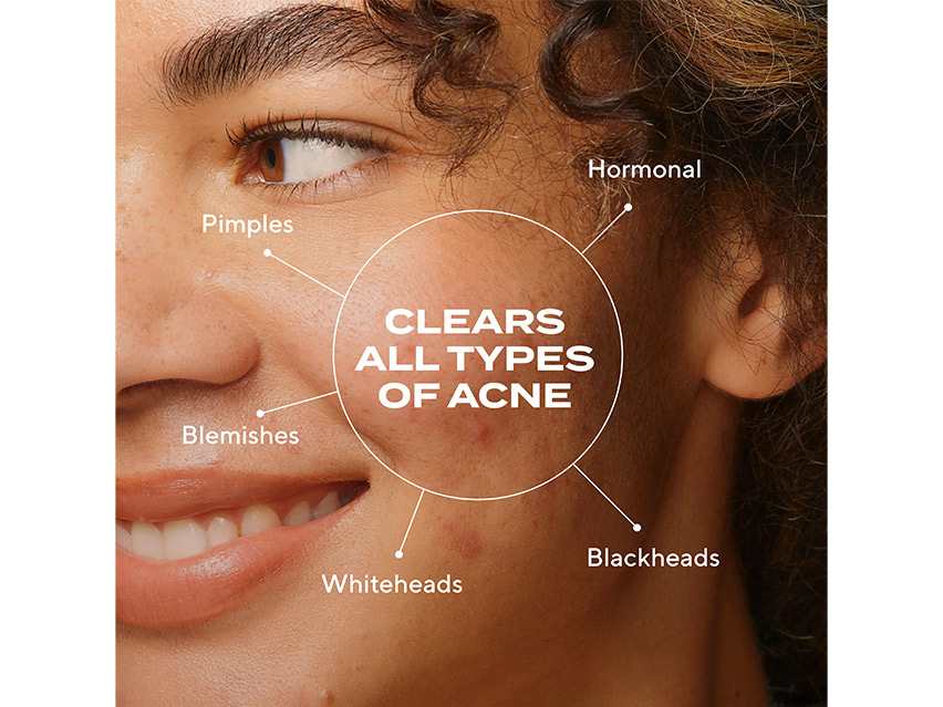 Murad Biome-Balancing Clear &amp; Prevent Acne Treatment Serum