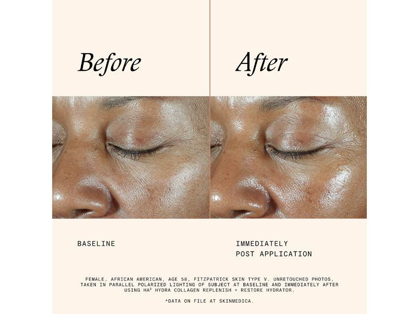 SkinMedica HA5 Hydra Collagen Replenish + Restore Hydrator