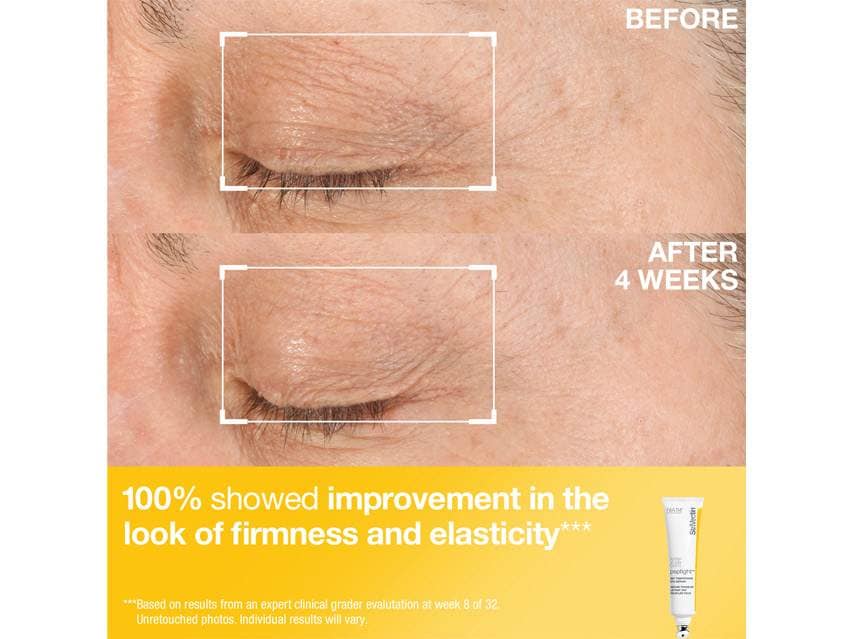 StriVectin Power Starters Tighten &amp; Lift Trio
