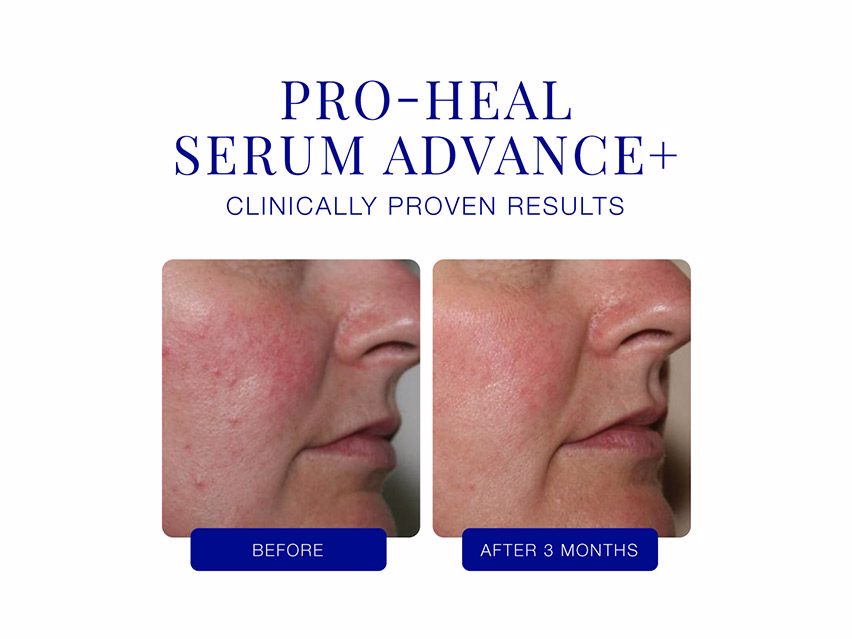 iS CLINICAL Pro-Heal Serum Advance+ - 0.5 fl oz