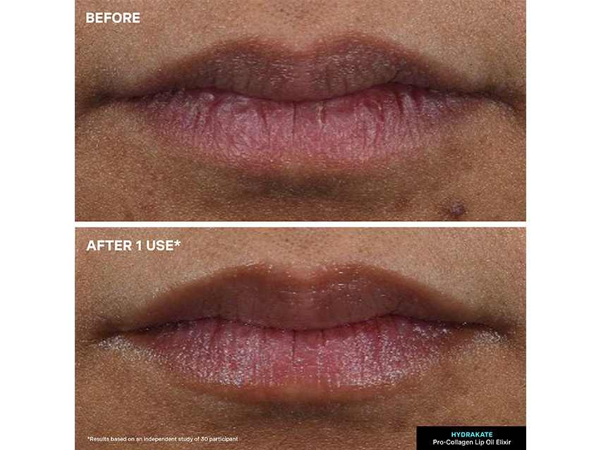 Kate Somerville HydraKate Lip Oil Elixir