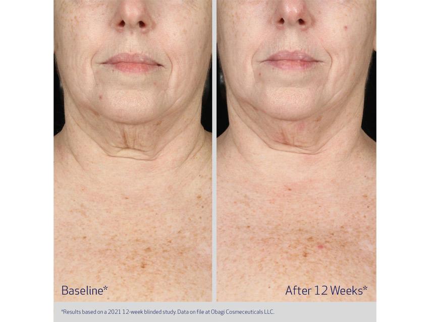 Obagi ELASTIderm Neck &amp; Decollete Concentrate