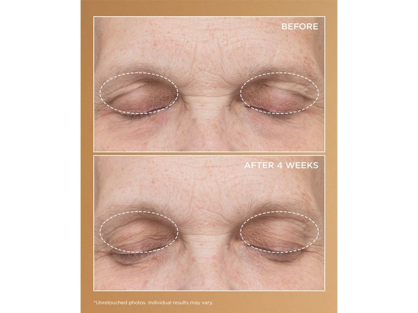 Perricone MD Neuropeptide Eyelid Lift Serum