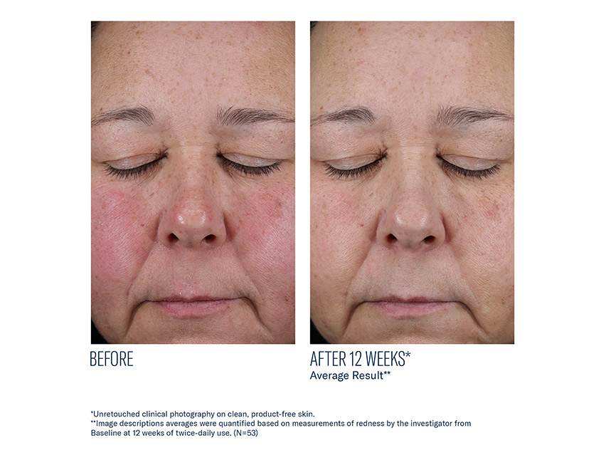 skinbetter science Mystro Active Balance Serum