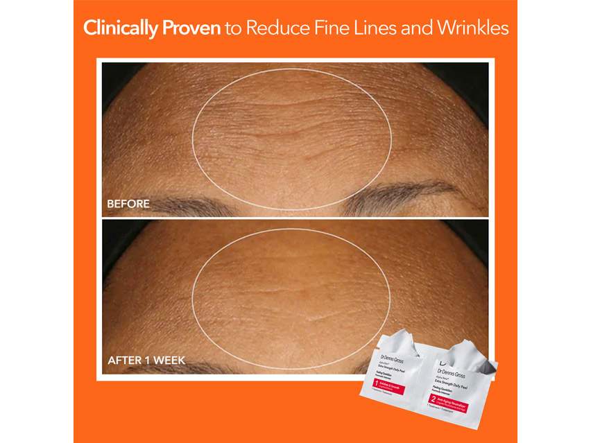 Dr. Dennis Gross Skincare Alpha Beta Extra Strength Daily Peel