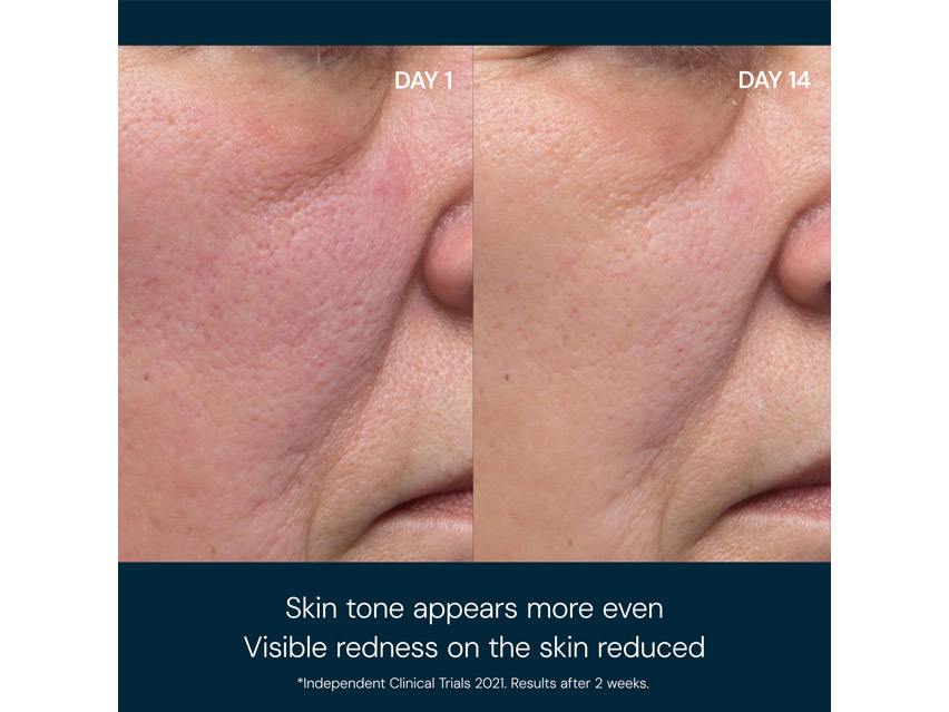 ELEMIS Dynamic Resurfacing Facial Pads