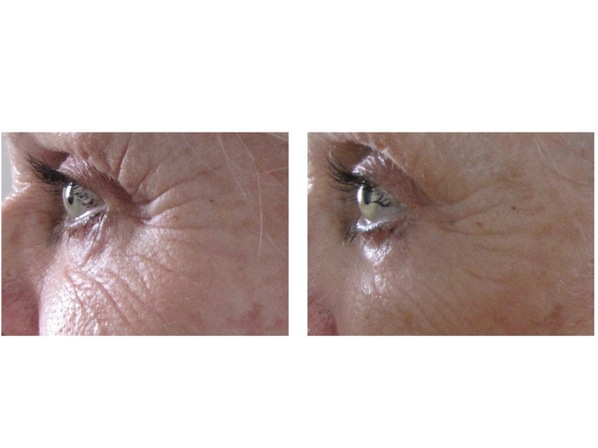 Airelle Age-Defying Eye + Lip Treatment