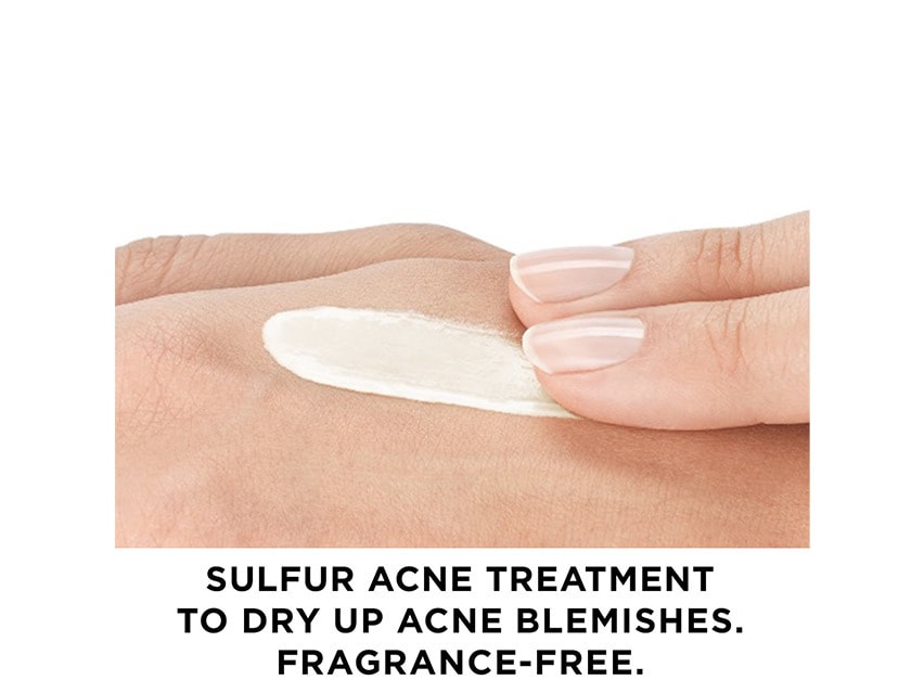 5 surprising reasons you have acne | Bonnie Garner – Skincare, makeup, nails
