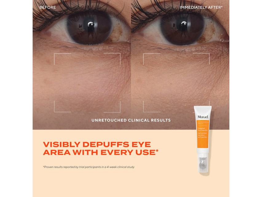 Murad Targeted Eye Depuffer