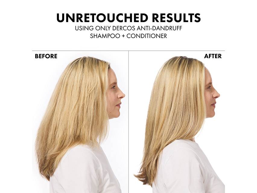 Vichy Dercos Selenium Sulfide Anti-Dandruff Shampoo