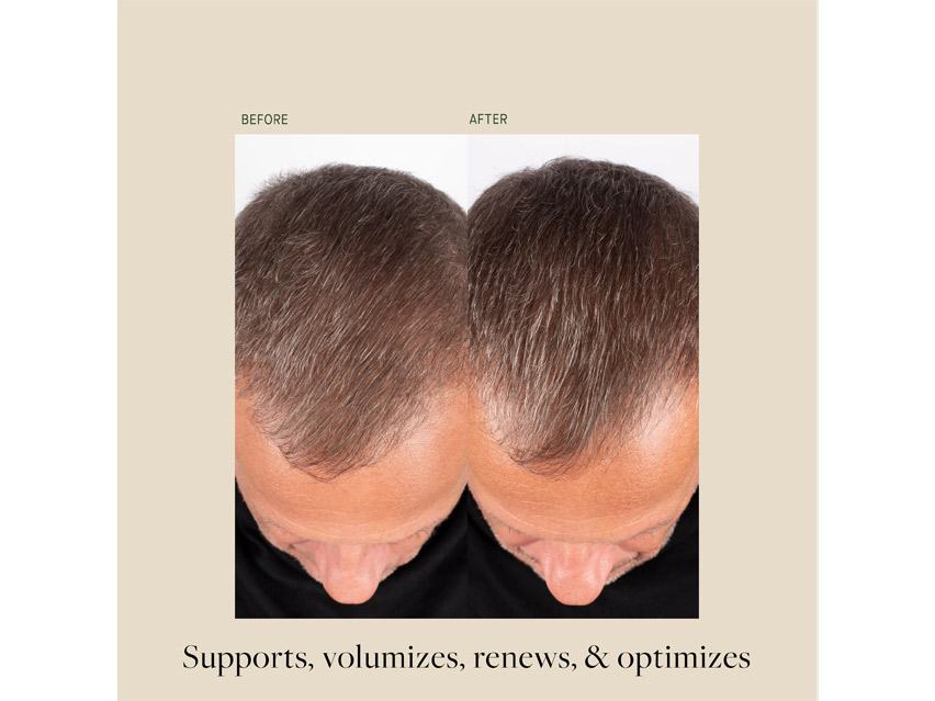 Kat Burki Health &amp; Vitality Hair Renewal Supplement