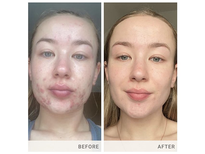 jane iredale Skin Accumax 14 Week Reset