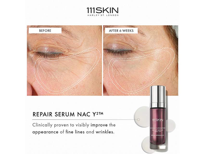 111SKIN Repair Serum NAC Y2