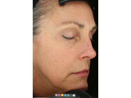 sente dermal contour pressed serum before and after