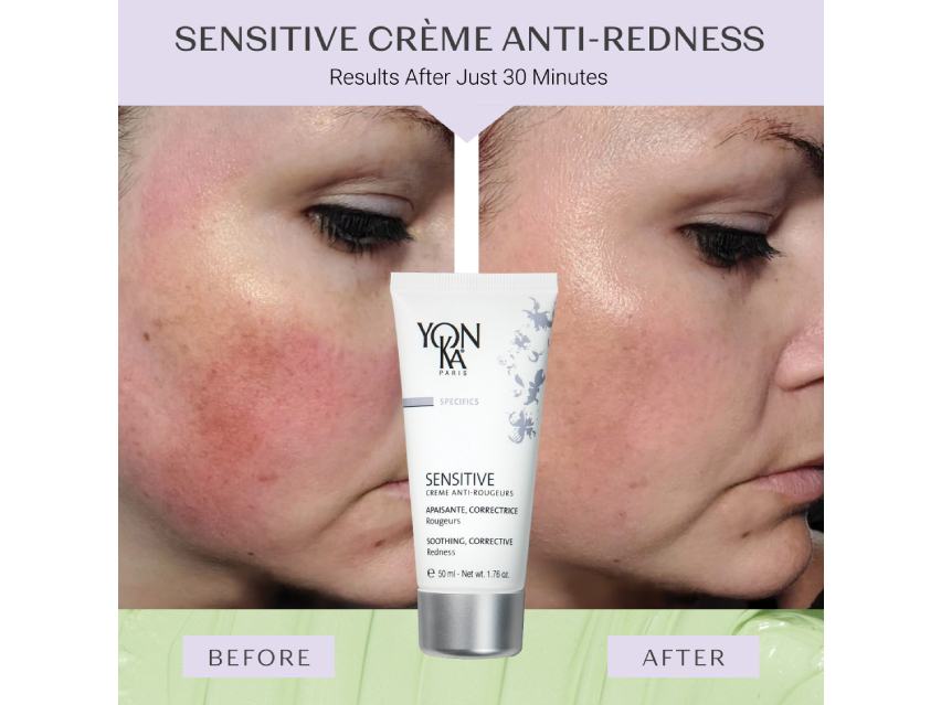 Yon-Ka Paris Anti-Redness Creme