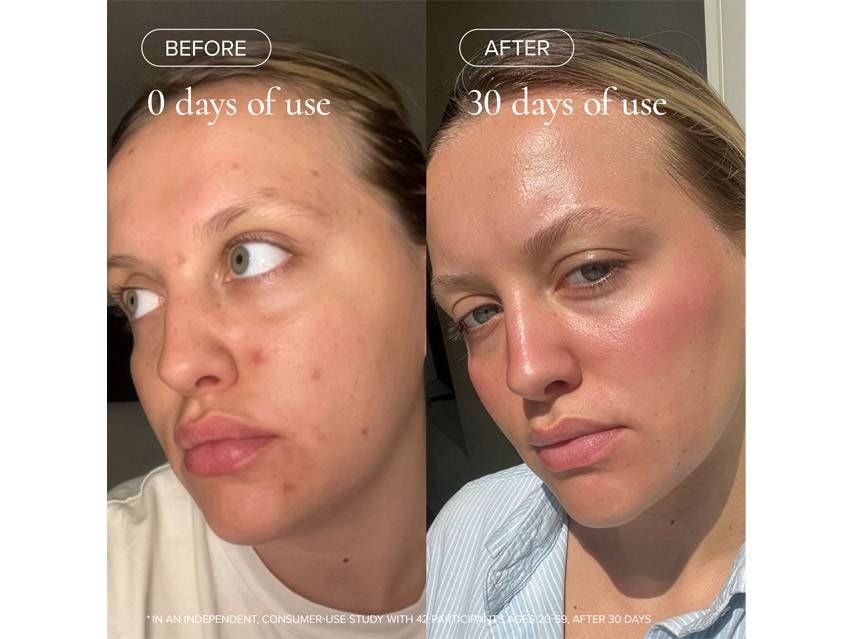 MARA Clear Skin Mineral Milk Acne Treatment